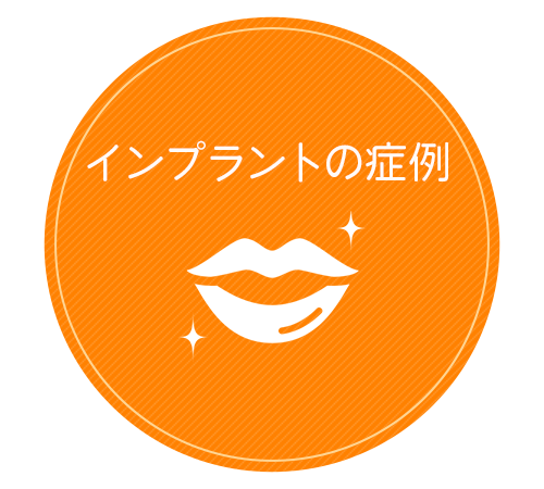 インプラントの症例